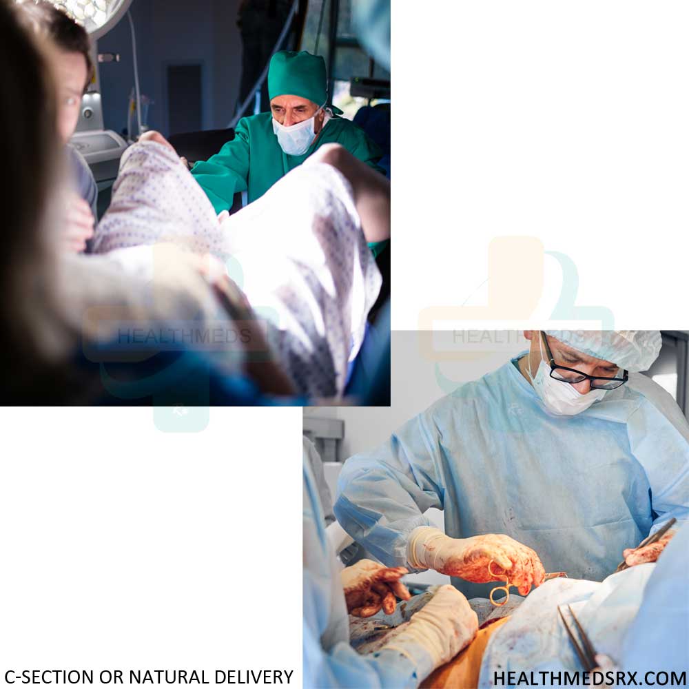 C-Section or Natural Delivery