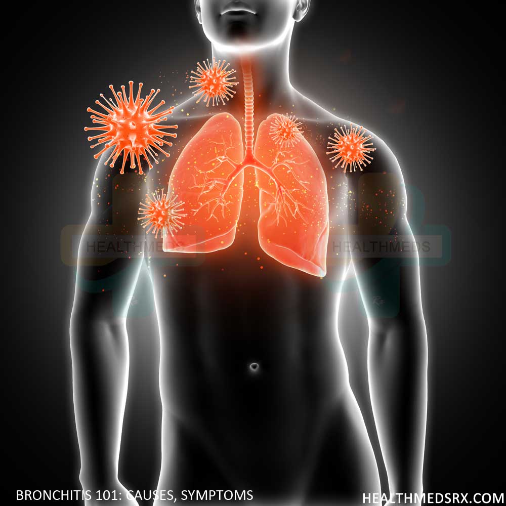 Bronchitis 101 Causes Symptoms