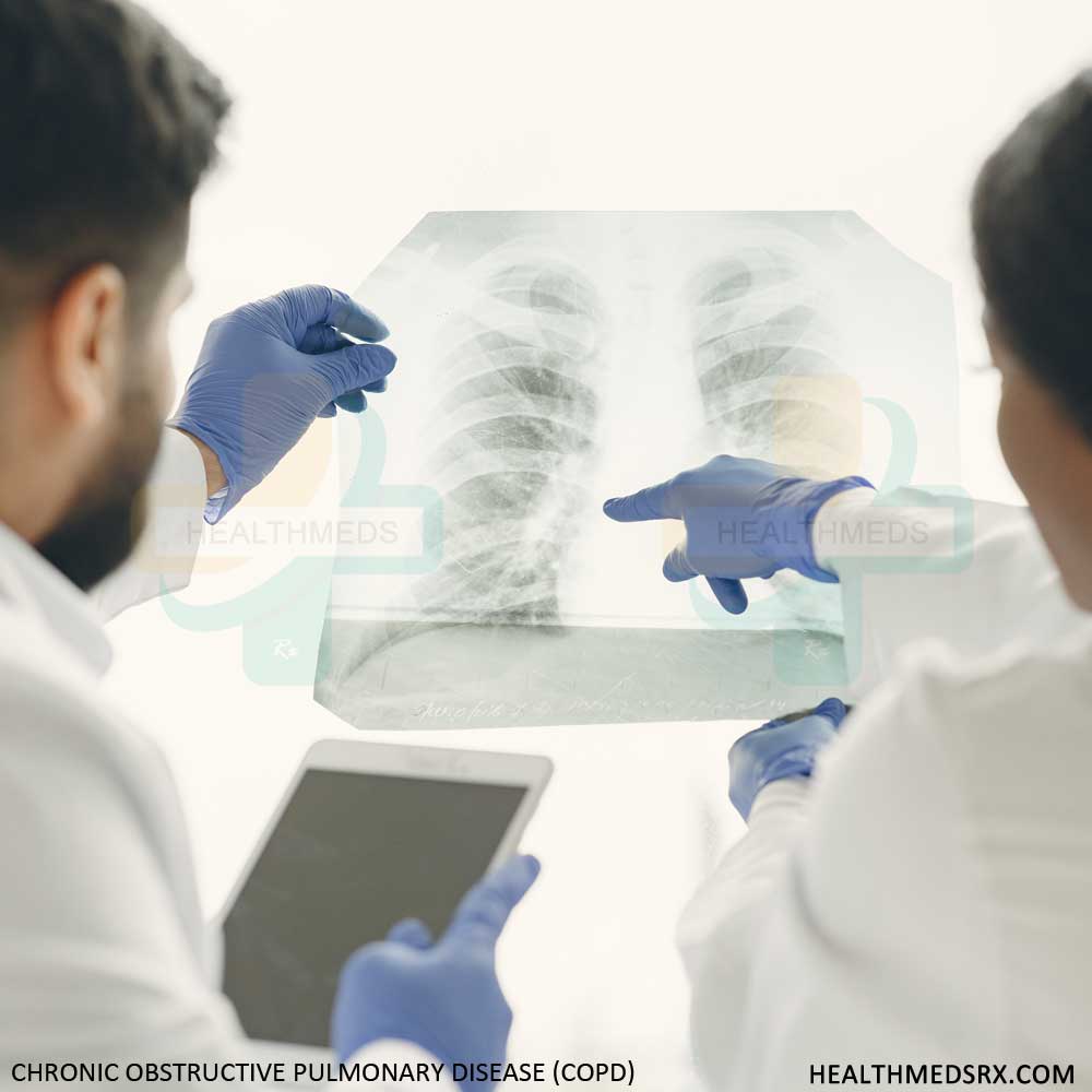 Chronic obstructive pulmonary disease