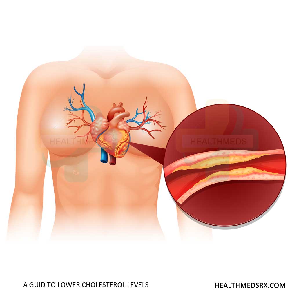 Lowering Cholesterol Levels