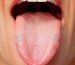 Tongue Health Indicators Explained