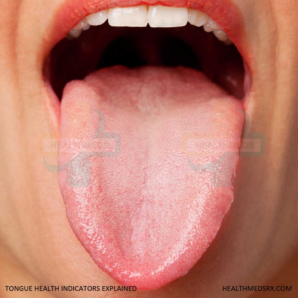 Tongue Health Indicators Explained