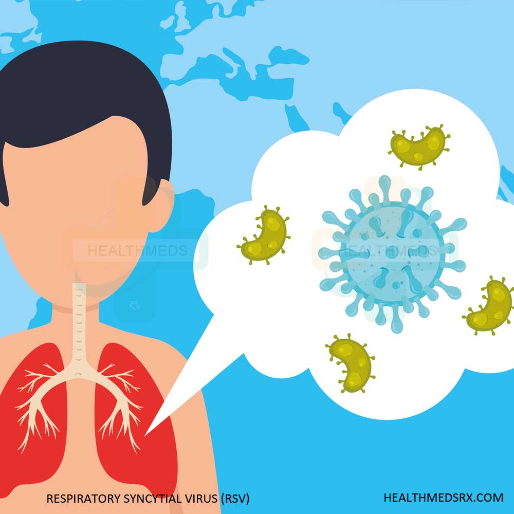 Respiratory Syncytial Virus